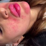 کلینیک زیبایی دایا در کرج