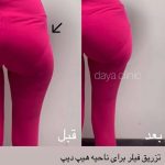 کلینیک زیبایی دایا در کرج