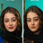 مطب زیبایی شاهرودی طب در سعادت آباد تهران