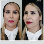 مطب زیبایی شاهرودی طب در سعادت آباد تهران