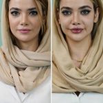 مطب زیبایی شاهرودی طب در سعادت آباد تهران