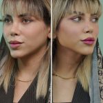 مطب زیبایی شاهرودی طب در سعادت آباد تهران