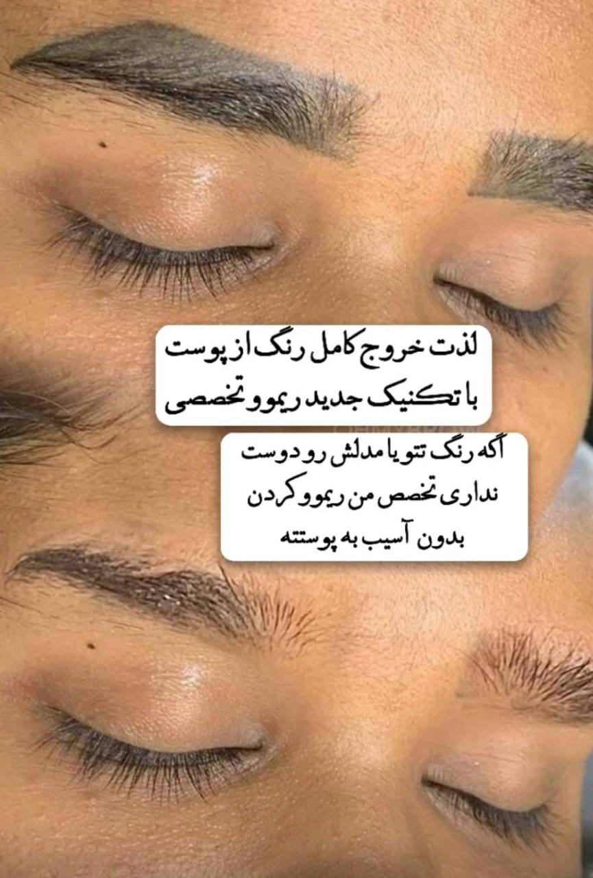 خدمات پیلینگ کربن مریم اسماعیلیان در اصفهان بدون درد-مشاغل ممتاز