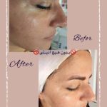 آموزش خدمات پاکسازی پوست شیوا خیراله‌پور در بابل