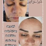 آموزش خدمات پاکسازی پوست شیوا خیراله‌پور در بابل