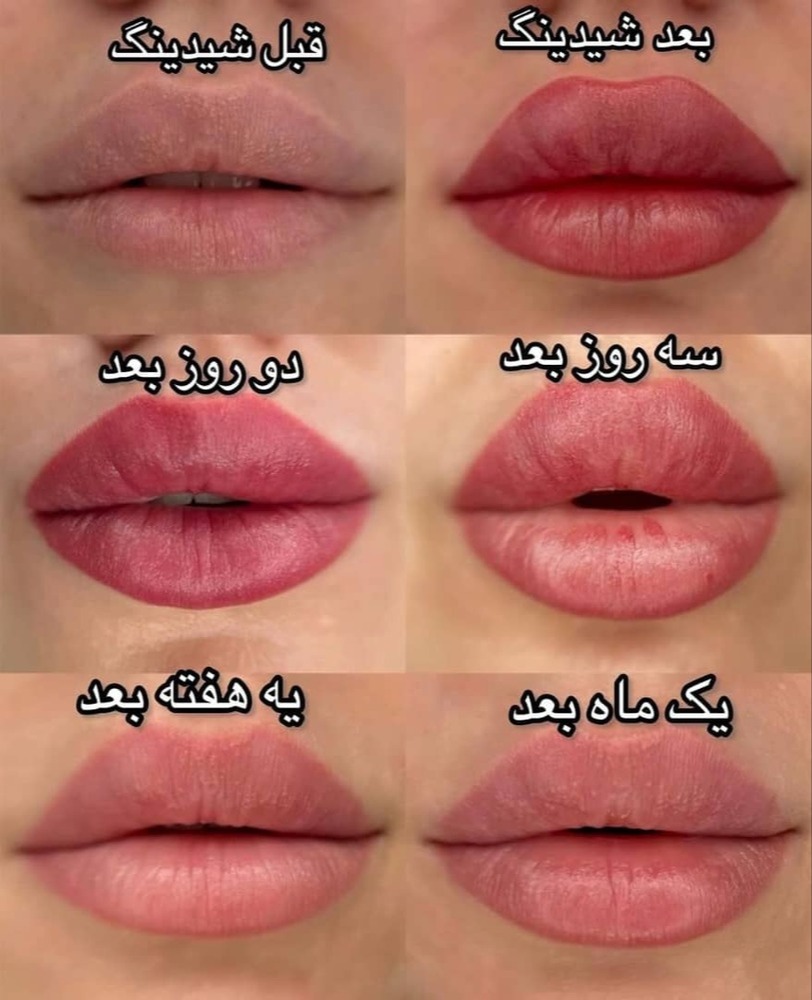 ماندگاری شیدینگ لب در گرگان زهرا اکرم‌زاده مدرس آرایش دائم، مشاغل ممتاز