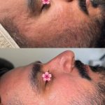 آموزش خدمات پاکسازی پوست رویا دهقانی در بندرعباس