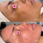 آموزش خدمات پاکسازی پوست رویا دهقانی در بندرعباس