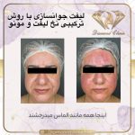 کلینیک زیبایی دایموند در شیراز
