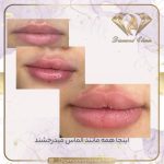 کلینیک زیبایی دایموند در شیراز