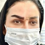 کاشت ابرو و مو سلطانی در شیراز