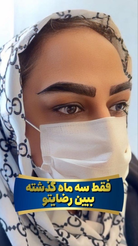 کاشت ابرو طبیعی در شیراز توسط مرکز کاشت ابرو و مو سلطانی-مشاغل ممتاز