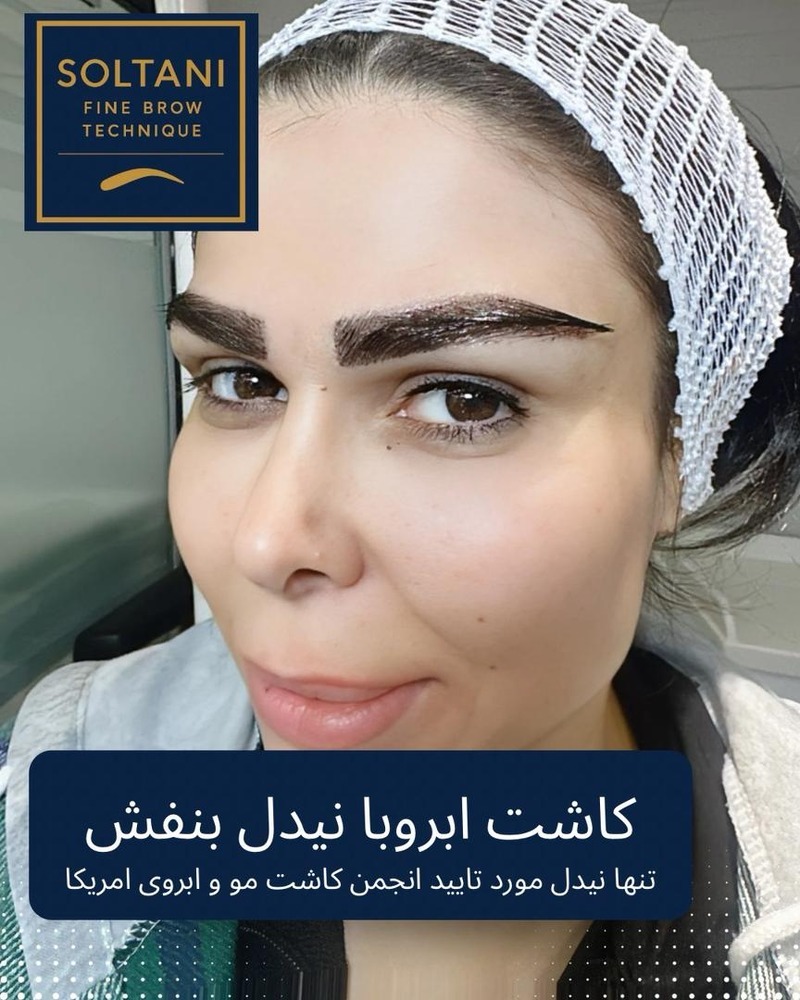 کاشت مو در شیراز | خدمات حرفه‌ای کاشت مو و ابرو در مرکز سلطانی-مشاغل ممتاز