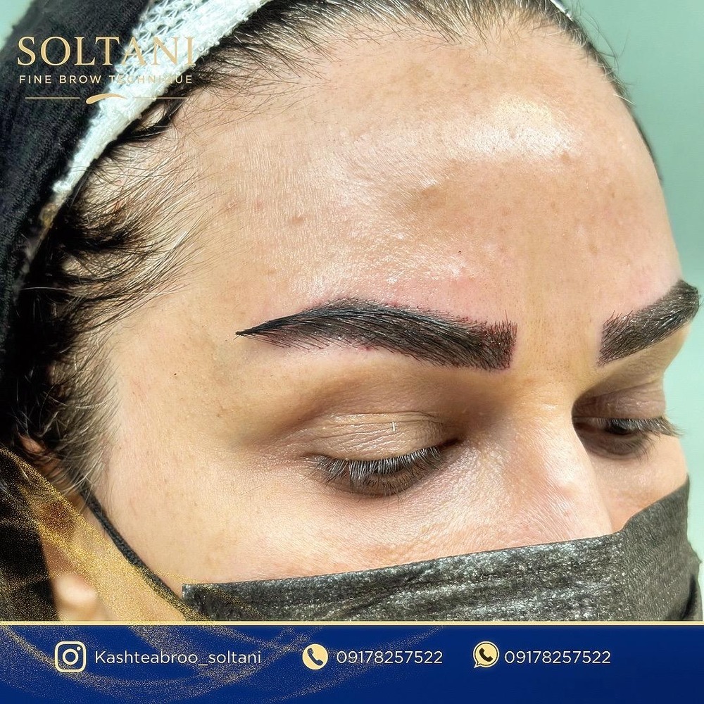 مرکز تخصصی کاشت مو و ابرو سلطانی در شیراز با طراحی کاملاً نچرال-مشاغل ممتاز