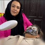 حذف دائمی کک و مک حسینی در مشهد