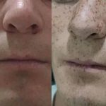 حذف دائمی کک و مک حسینی در مشهد