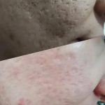 حذف دائمی کک و مک حسینی در مشهد
