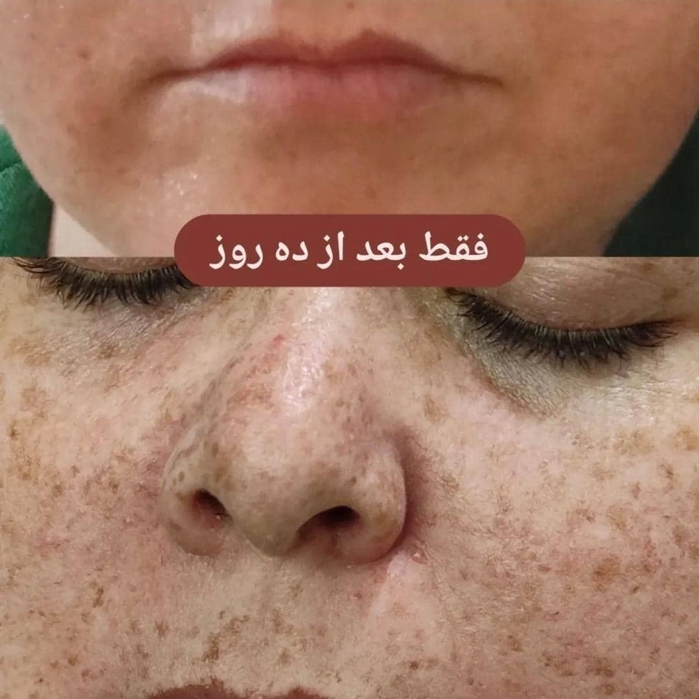 حذف دائمی کک و مک حسینی در مشهد-مشاغل ممتاز