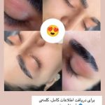 خدمات خالبرداری گیاهی دائمی در بجنورد