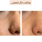 خدمات خالبرداری گیاهی دائمی در بجنورد