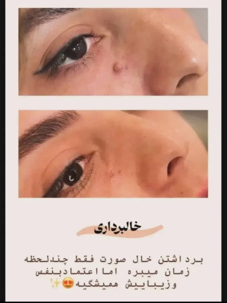 خدمات خالبرداری گیاهی دائمی در بجنورد-مشاغل ممتاز