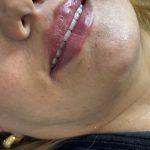 کلینیک تخصصی فیلر بادی دکتر بابک واحدی در تبریز