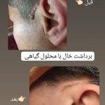 خدمات خالبرداری گیاهی دائمی در بجنورد