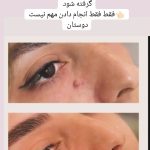 خدمات خالبرداری گیاهی دائمی در بجنورد