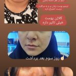 خدمات خالبرداری گیاهی دائمی در بجنورد