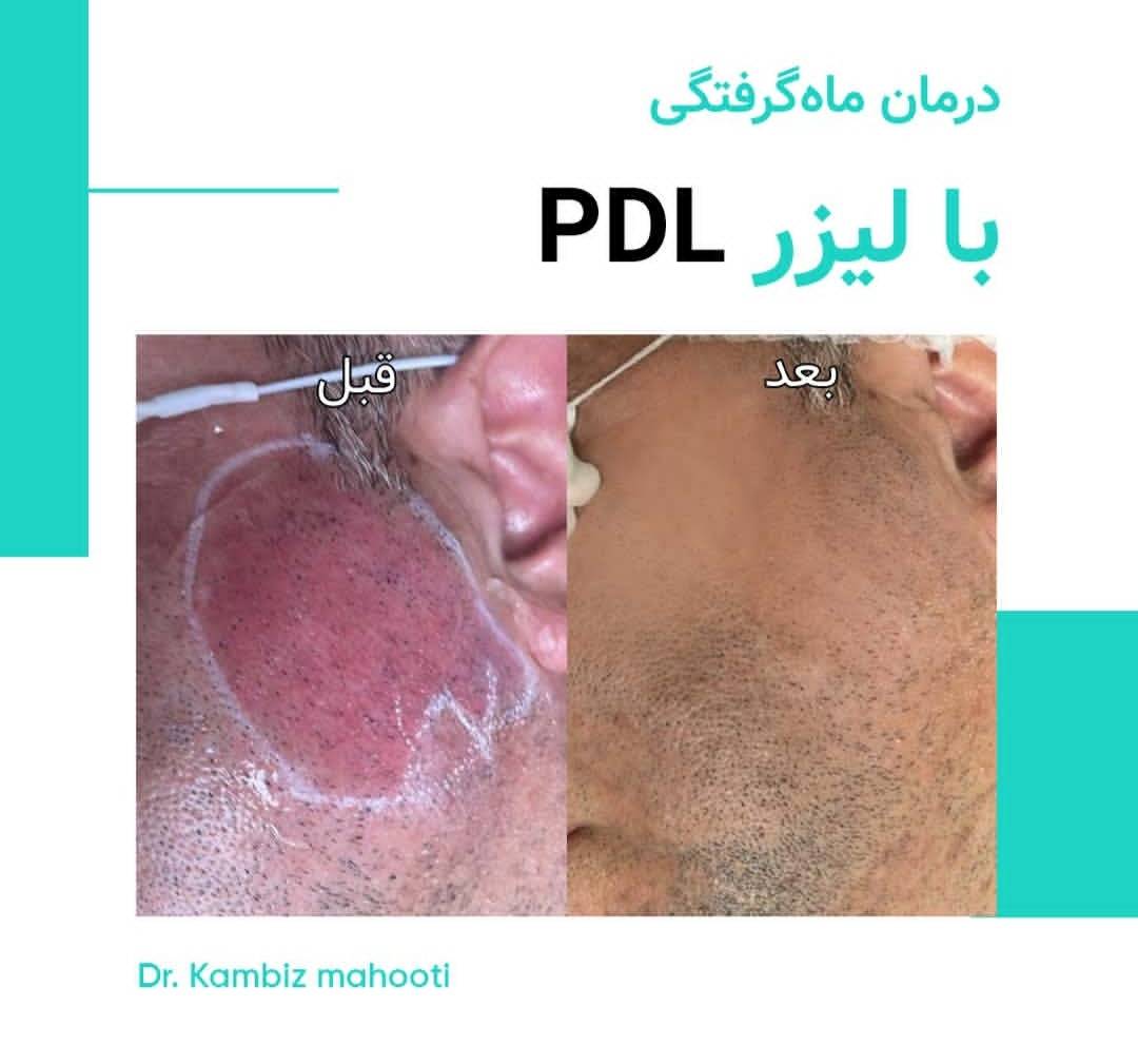 درمان سوختگی دکتر کامبیز ماهوتی در رشت-مشاغل ممتاز