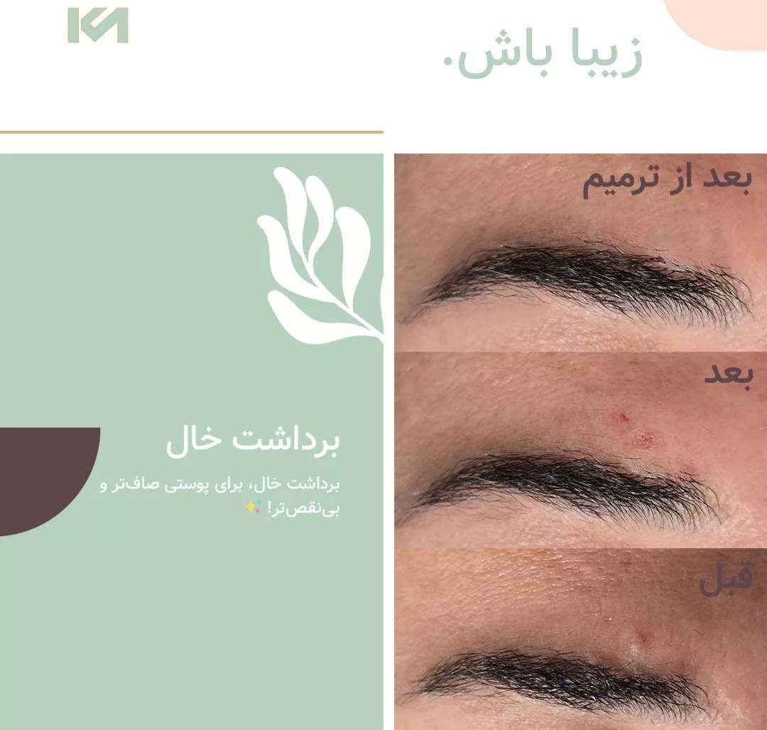 درمان خال دکتر کامبیز ماهوتی در رشت-مشاغل ممتاز