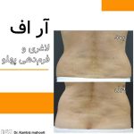 متخصص پوست و مو دکتر کامبیز ماهوتی در رشت