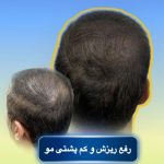 کلینیک پوست و مو ریشه در بهبهان