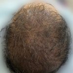کلینیک پوست و مو ریشه در بهبهان