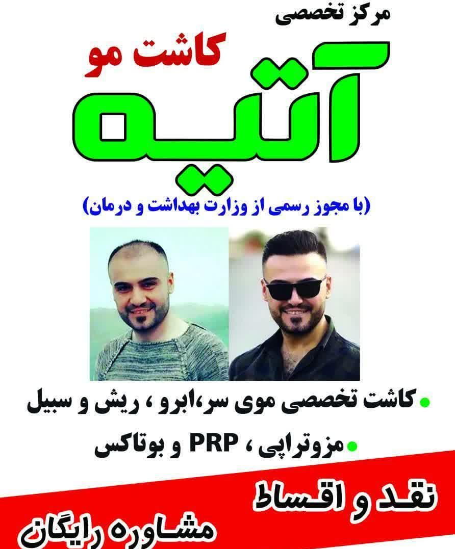بهترین مرکز کاشت مو در یزد کلینیک آتیه_مشاغل ممتاز