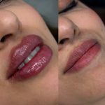 کلینیک زیبایی کهربا شهرری