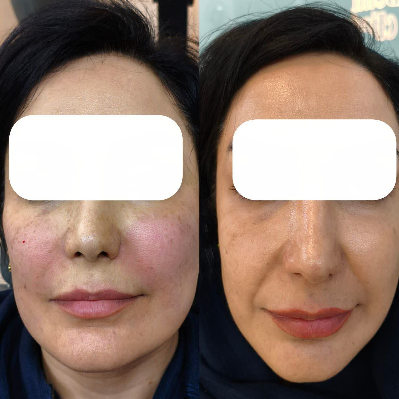 مرکز زیبایی کهربا شهرری | خدمات تخصصی پوست، مو و زیبایی | مشاغل ممتاز