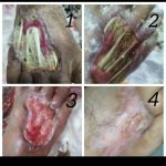 خدمات پرستاری در منزل آتیه سلامت مشهد