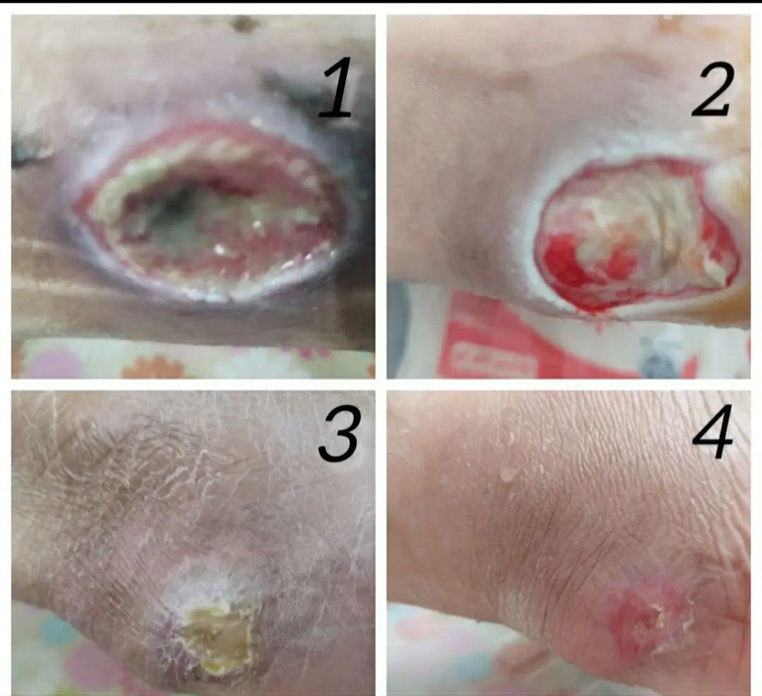 ارائه خدمات پرستاری در منزل آتیه سلامت مشهد شامل تزریقات، پانسمان و درمان زخم-مشاغل ممتاز