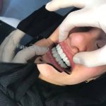 کلینیک دندانپزشکی کامپوزیت شو در ساری