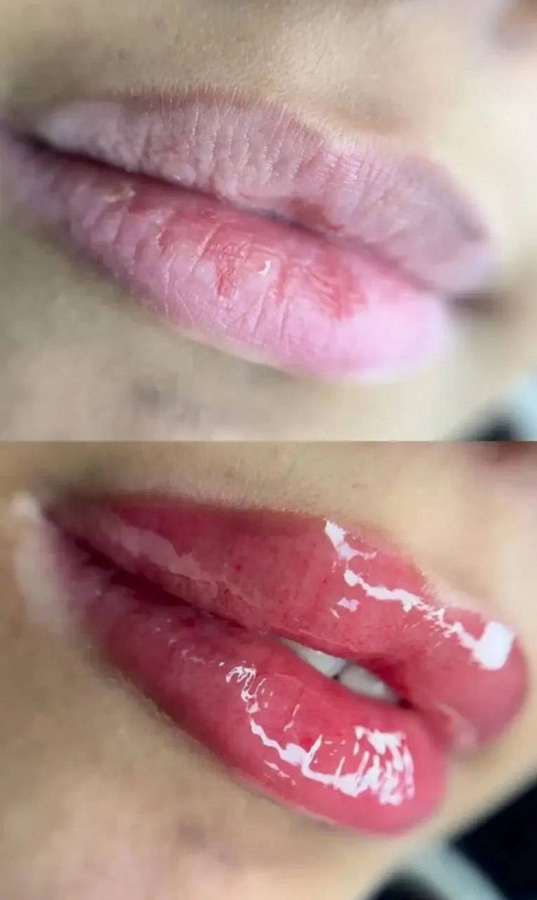 خدمات شیدینگ لب شهره ناصری در متل قو-مشاغل ممتاز