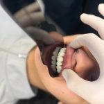 کلینیک دندانپزشکی کامپوزیت شو در ساری