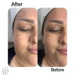 خدمات پاکسازی پوست فریما حقدوست در بابل