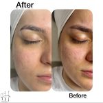 خدمات پاکسازی پوست فریما حقدوست در بابل