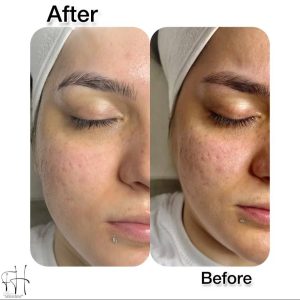 خدمات پاکسازی پوست فریما حقدوست در بابل-مشاغل ممتاز