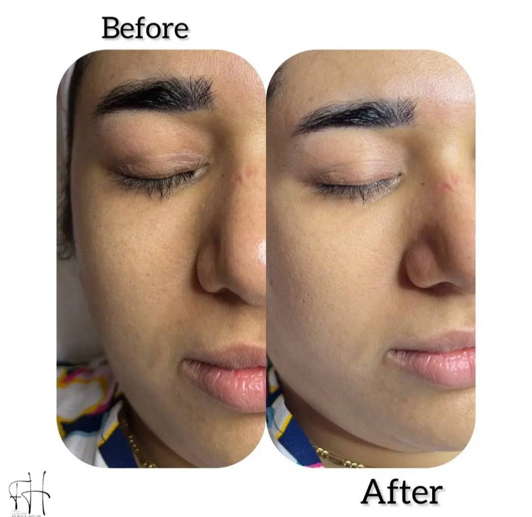 پاکسازی صورت و جوانسازی پوست در بابل فریما حقدوست -مشاغل ممتاز