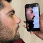 جراحی زیبایی بینی دکتر ابولحسن علی جانپور در بابل