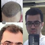 کلینیک زیبایی وانیل سنندج
