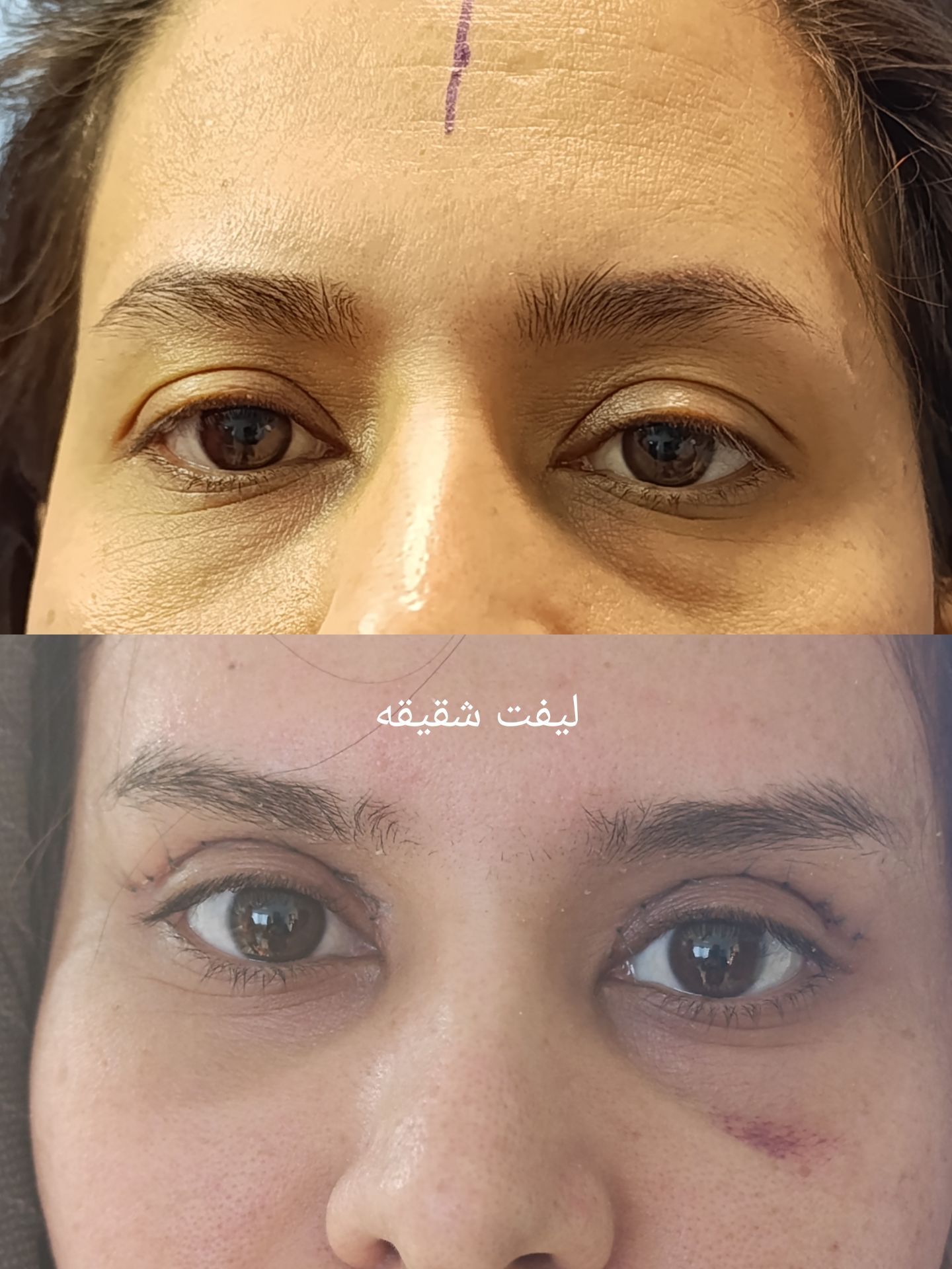 بلفاپلاروستی کلینیک زیبایی دکتر امیریان شیراز-مشاغل ممتاز