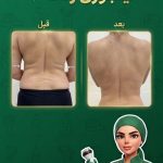 لاغری موضعی بانوان غزاله نوروزی همدان